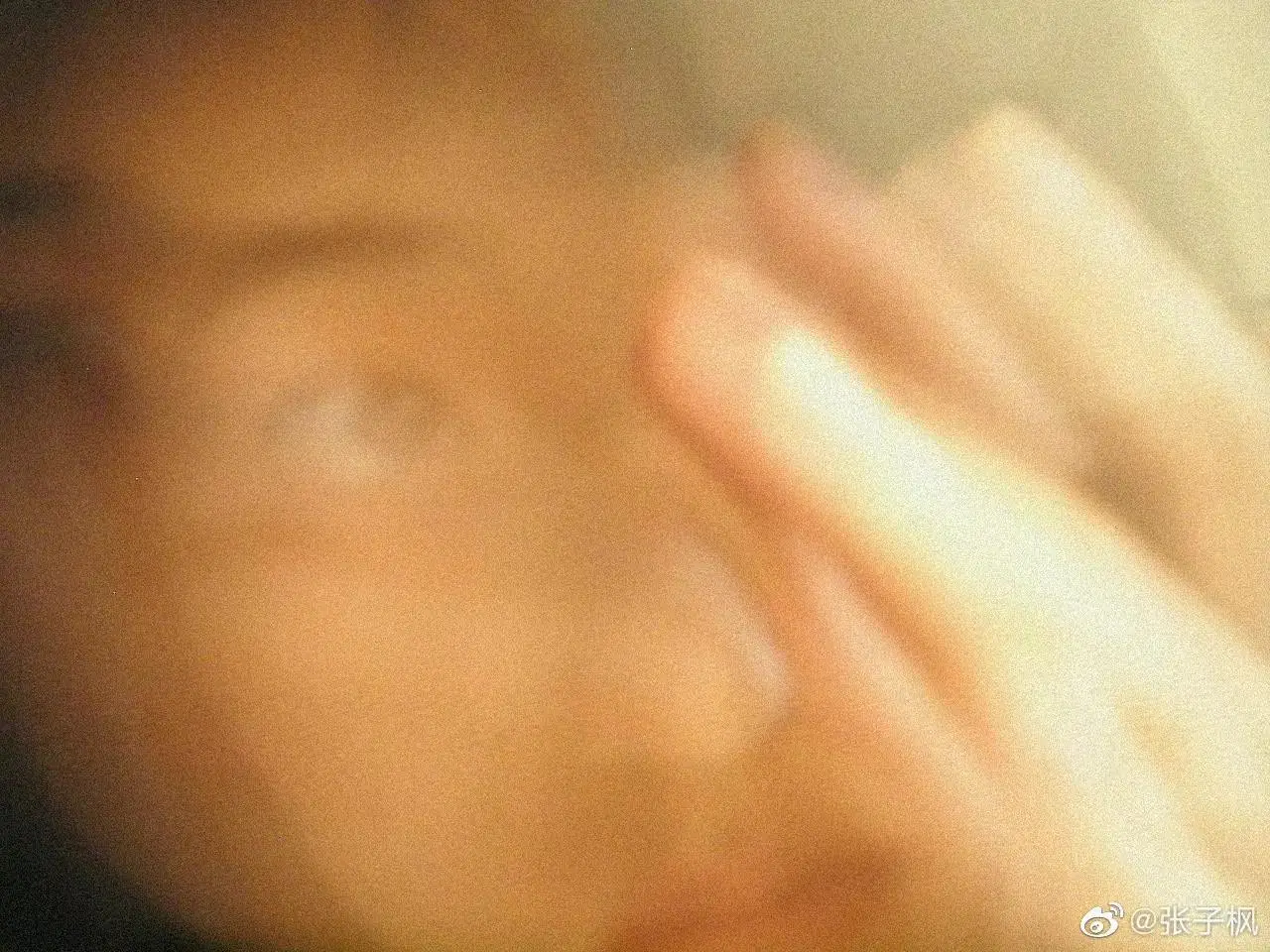 张子枫晒素颜自拍 妹妹皮肤真的好好,胶原蛋白满满,狠狠地羡慕了 张子枫晒素颜自拍 妹妹皮肤真的好好,胶原蛋白满满,狠狠地羡慕了