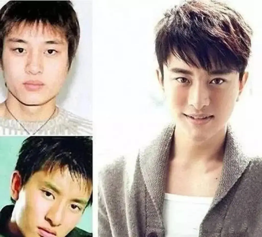 男明星整容前后对比!黄晓明原来以前长这样? 男明星整容前后对比!黄晓明原来以前长这样?