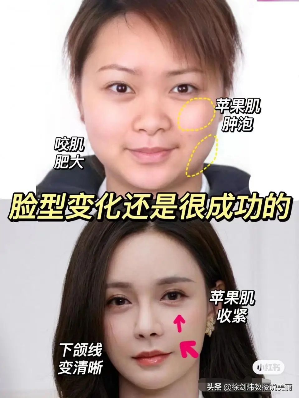 沈梦辰的逆袭之路 沈梦辰的逆袭之路