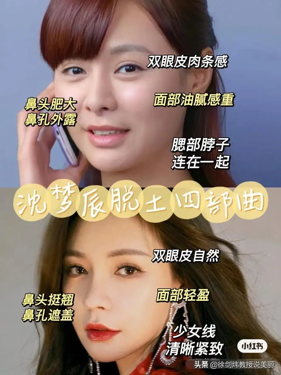 沈梦辰的逆袭之路 沈梦辰的逆袭之路