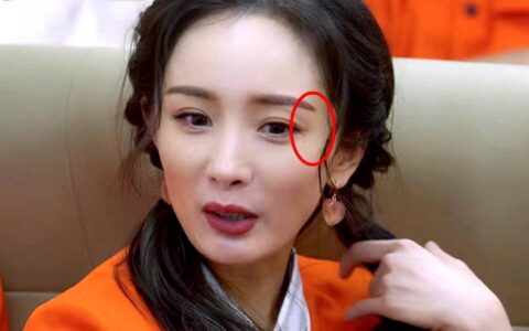 杨幂眼角受伤两个月，伤疤首度曝光，长达三四厘米，化妆也遮不住