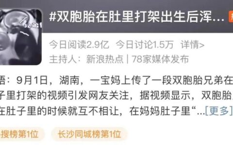 双胞胎肚里打架出生后浑身淤青？产科医生：都不在一个“房间”