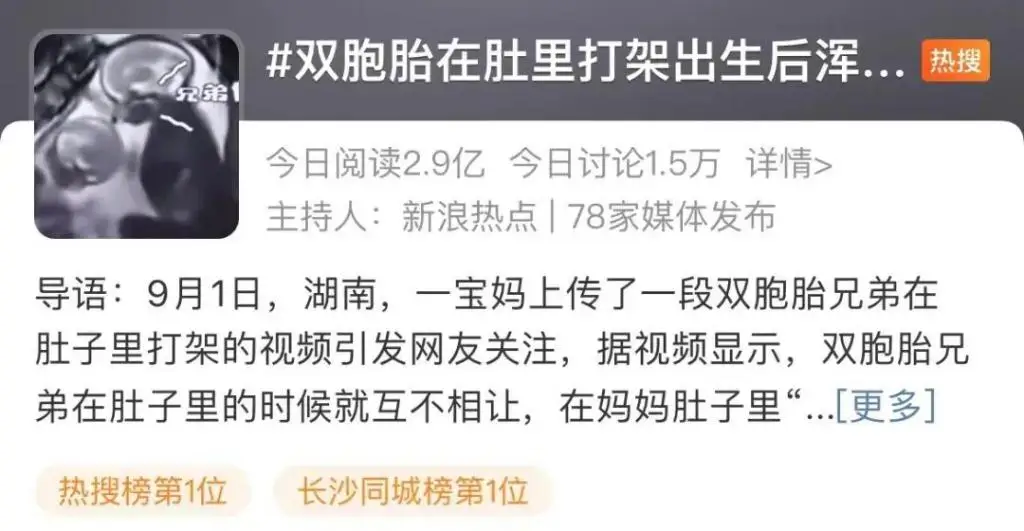 双胞胎肚里打架出生后浑身淤青？产科医生：都不在一个“房间”