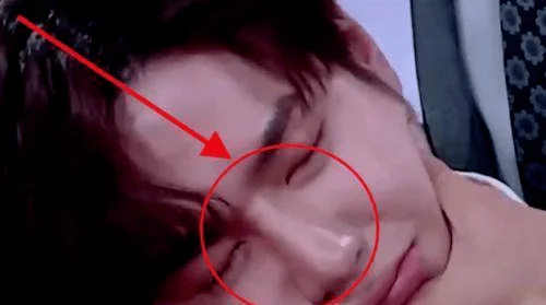 王一博，真的别演戏了！整容痕迹在镜头下暴露了无数次