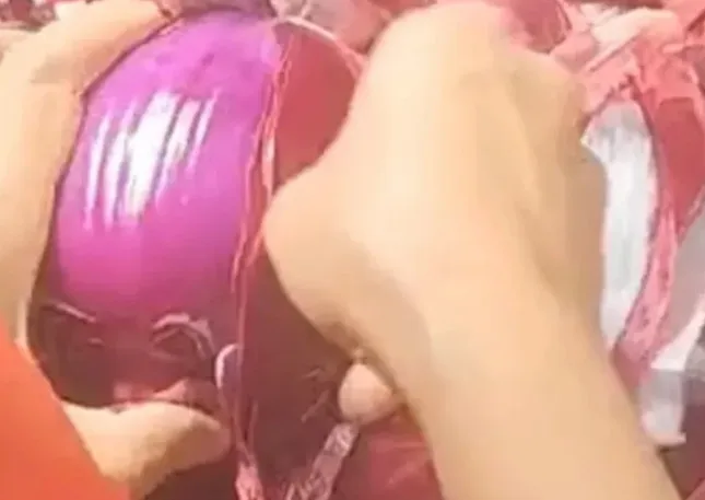 大妈超市买洋葱挨个剥皮减重，网友：没素质，贪小便宜！