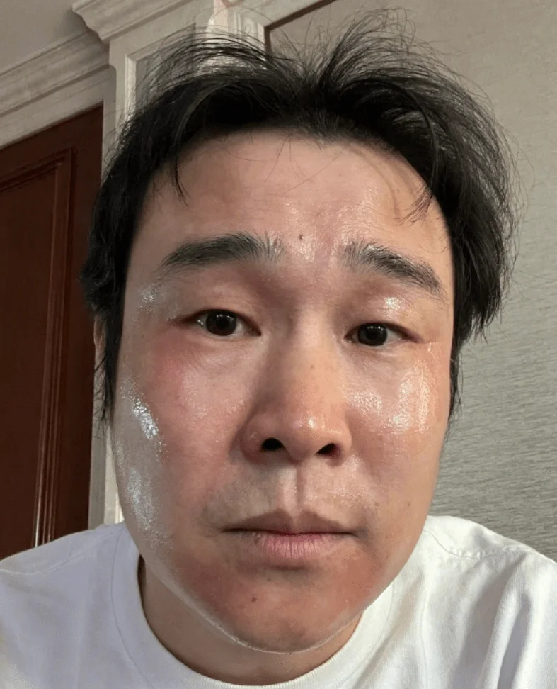 张靓颖确诊新冠！为演唱会故意被传染，发烧头晕全身酸痛一天痊愈