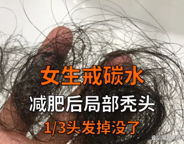女子不吃碳水半年减46斤脱发严重 最终减肥效果竟然是这样! 女子不吃碳水半年减46斤脱发严重 最终减肥效果竟然是这样!