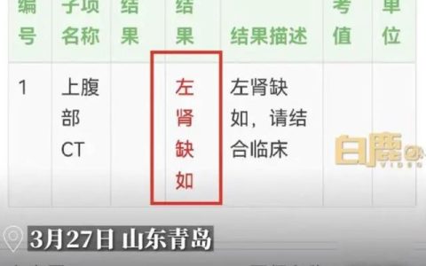 24岁女孩入职体检查出少一个肾：父母在其小时候就知道，一直瞒着