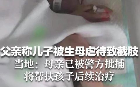 父亲称儿子被生母虐待致截肢 当地：母亲已被警方批捕，将帮扶孩子后续治疗