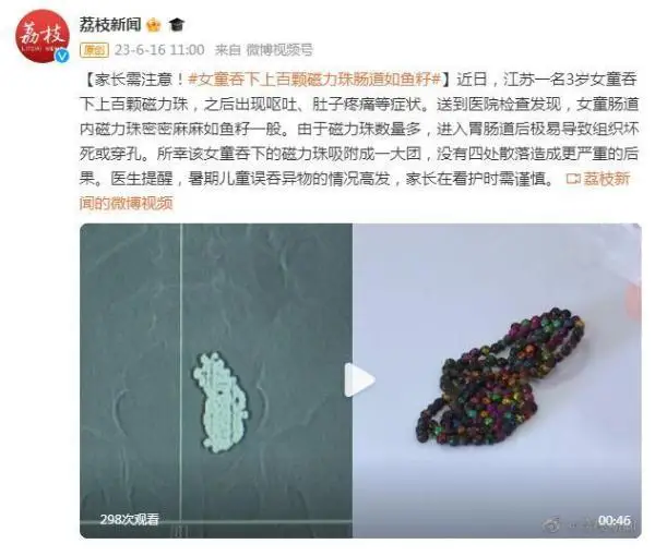 家长需注意!3岁女童吞下上百颗磁力珠肠道如鱼籽 家长需注意!3岁女童吞下上百颗磁力珠肠道如鱼籽